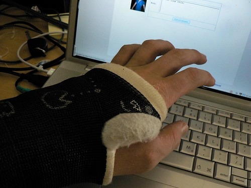 サポーターを付けてパソコンを操作する男性の手