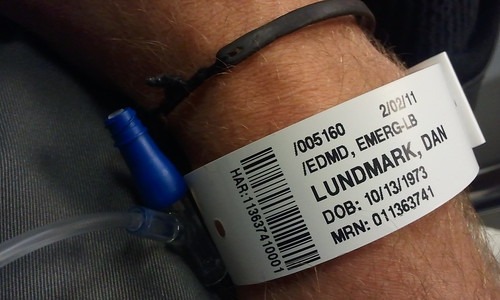 脱臼した男性の手首