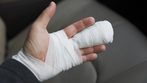 左手中指をギプスで固定した男性