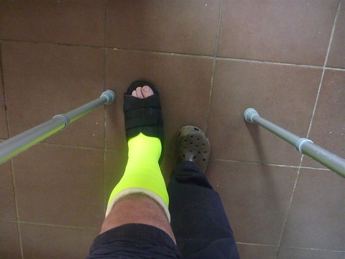 交通事故で骨折した足