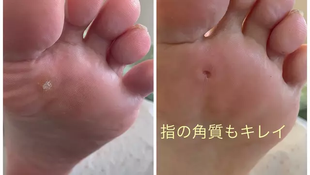 ひふみ鍼灸接骨院