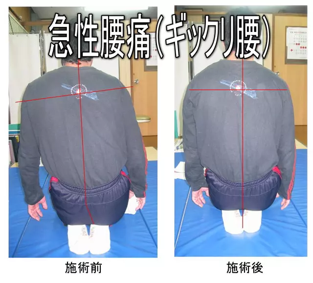 松江整骨院