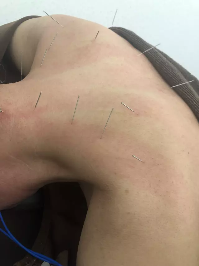 ナルシス鍼灸整骨院