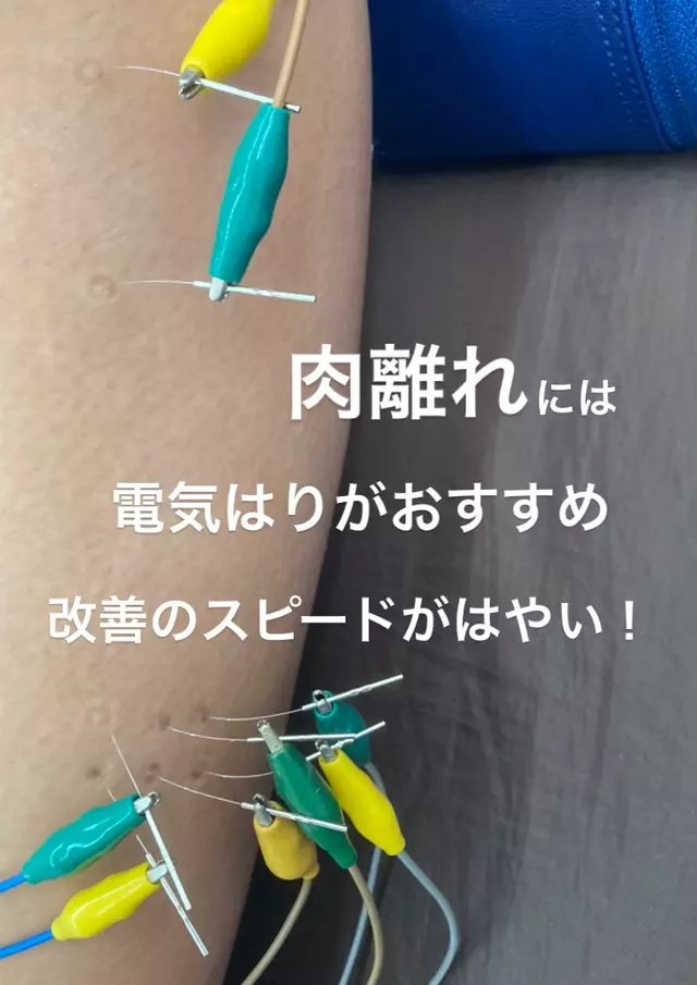 ゆう針灸整骨院