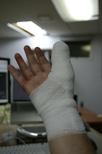 右手親指に包帯を巻いた男性の手