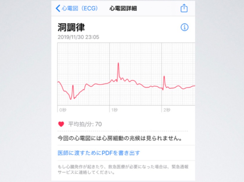 ③結果が表示される
