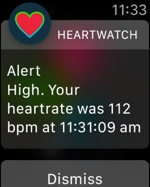 心拍がわかる「HeartWatch」 の特徴