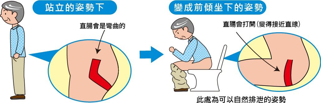排便姿勢