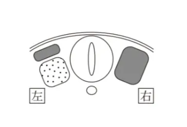 解答選択肢の画像