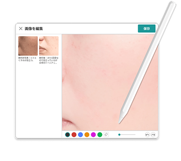 画像アップロード・比較 画面