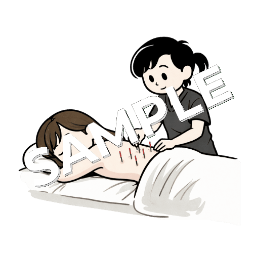 女性患者の腰に鍼治療をしている女性鍼灸師のイラスト