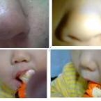 「スッキリ毛穴ブラザーズ'vs毛穴黒ずみな私」モニプラリニューアル記念「毛穴の黒ずみ自慢コンテスト」の投稿画像