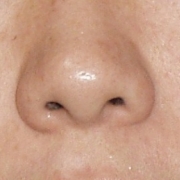 「毛穴が目立つのが嫌です。」モニプラリニューアル記念「毛穴の黒ずみ自慢コンテスト」の投稿画像