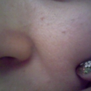 「これでもメイクしてるのですが」モニプラリニューアル記念「毛穴の黒ずみ自慢コンテスト」の投稿画像