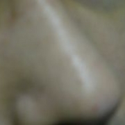 「毛穴の汚れは長年の悩みです。」モニプラリニューアル記念「毛穴の黒ずみ自慢コンテスト」の投稿画像