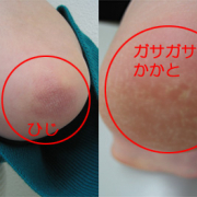 「顔はもちろん、【ひじ】も【かかと】も」【30秒で毛穴黒ずみ・くすみOFF！ピーリング】モニター募集byフューチャーラボの投稿画像