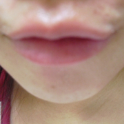 「チャームポイント（*^_^*）」【第１回KISSしたくなる肌プロジェクト】あなたの自慢の『 唇 』写メ大募集♪の投稿画像