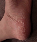 「ベビーフット、使ってみました。」の画像