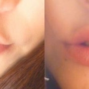 「ビフォー・アフター」【第5回KISSしたくなる肌プロジェクト】 あなたの自慢の『 唇 』写メ大募集の投稿画像