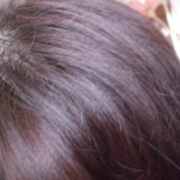 「薄毛です・・・悲」髪は女の命！発売前女性向け美髪サプリ★ヘアドルーチェ★じっくり6ヵ月長期モニターの投稿画像