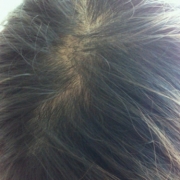 「恥ずかしい...。」髪は女の命！発売前女性向け美髪サプリ★ヘアドルーチェ★じっくり6ヵ月長期モニターの投稿画像