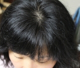 「頭の正面から頂点部分が薄くなってきました」の画像（1枚目）