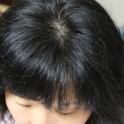 「頭の正面から頂点部分が薄くなってきました」髪は女の命！発売前女性向け美髪サプリ★ヘアドルーチェ★じっくり6ヵ月長期モニターの投稿画像