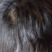 「髪の毛のケア」髪は女の命！発売前女性向け美髪サプリ★ヘアドルーチェ★じっくり6ヵ月長期モニターの投稿画像