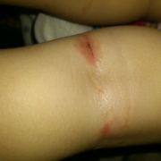 「身体中に……」ママと子供で笑顔で一緒にスキンケア！！の投稿画像