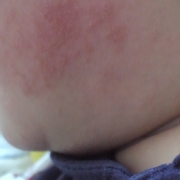 「ほっぺが…」ママと子供で笑顔で一緒にスキンケア！！の投稿画像