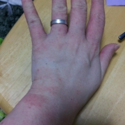 「アトピー性皮膚炎」ママと子供で笑顔で一緒にスキンケア！！の投稿画像