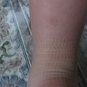 「息子の足です。」ママと子供で笑顔で一緒にスキンケア！！の投稿画像