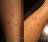 「２週間使用して。」の画像（1枚目）