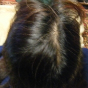 「抜け毛、薄毛、ぺったんこ…悩みだらけ」6箱分長期モニター【ＩＧＦ－１育毛理論】の女性専用サプリ「ヘアドルーチェ」の投稿画像