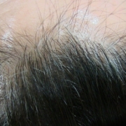 「画像」6箱分長期モニター【ＩＧＦ－１育毛理論】の女性専用サプリ「ヘアドルーチェ」の投稿画像