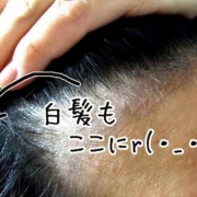 「色々悩み」6箱分長期モニター【ＩＧＦ－１育毛理論】の女性専用サプリ「ヘアドルーチェ」の投稿画像