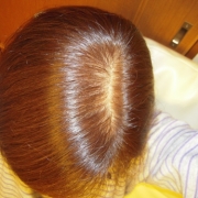 「最近、抜け毛が多くて・・・」6箱分長期モニター【ＩＧＦ－１育毛理論】の女性専用サプリ「ヘアドルーチェ」の投稿画像