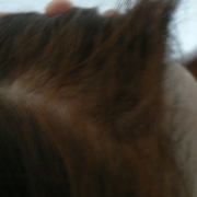 「薄くなってきたような。。。」6箱分長期モニター【ＩＧＦ－１育毛理論】の女性専用サプリ「ヘアドルーチェ」の投稿画像