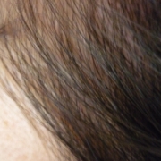 「サイド部分」6箱分長期モニター【ＩＧＦ－１育毛理論】の女性専用サプリ「ヘアドルーチェ」の投稿画像