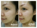 「レイティストエッセンスを使用したBefore・After」の画像（1枚目）