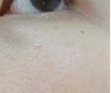 「ツルスベ肌自慢☆」の画像（1枚目）