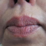 「気がつけば・・・」女のうっかり毛コンテスト！優勝者にはフェイスヘアーブロック3本プレゼント！の投稿画像