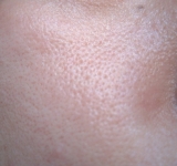 毛穴気になります＞＜；