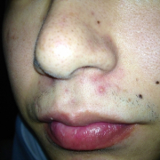 「毛」女のうっかり毛コンテスト！優勝者にはフェイスヘアーブロック3本プレゼント！の投稿画像