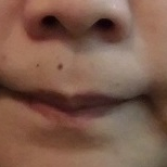 「何故か鼻の下が・・・」女のうっかり毛コンテスト！優勝者にはフェイスヘアーブロック3本プレゼント！の投稿画像