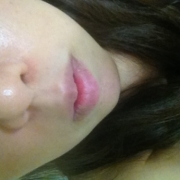 「毛穴バックリでキツイ画だなぁ」角質ごっそりコンテスト！優勝者にはスキンブライトニングパック5個プレゼント！　の投稿画像