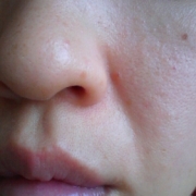 「ザラザラ素肌」角質ごっそりコンテスト！優勝者にはスキンブライトニングパック5個プレゼント！　の投稿画像