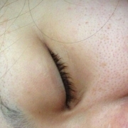 「くすみ  毛穴」角質ごっそりコンテスト！優勝者にはスキンブライトニングパック5個プレゼント！　の投稿画像