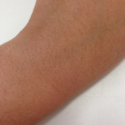 「腕毛」女のうっかり毛コンテスト！優勝者にはフェイスヘアーブロック3本プレゼント！の投稿画像