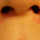 「頬」角質ごっそりコンテスト！優勝者にはスキンブライトニングパック5個プレゼント！　の投稿画像